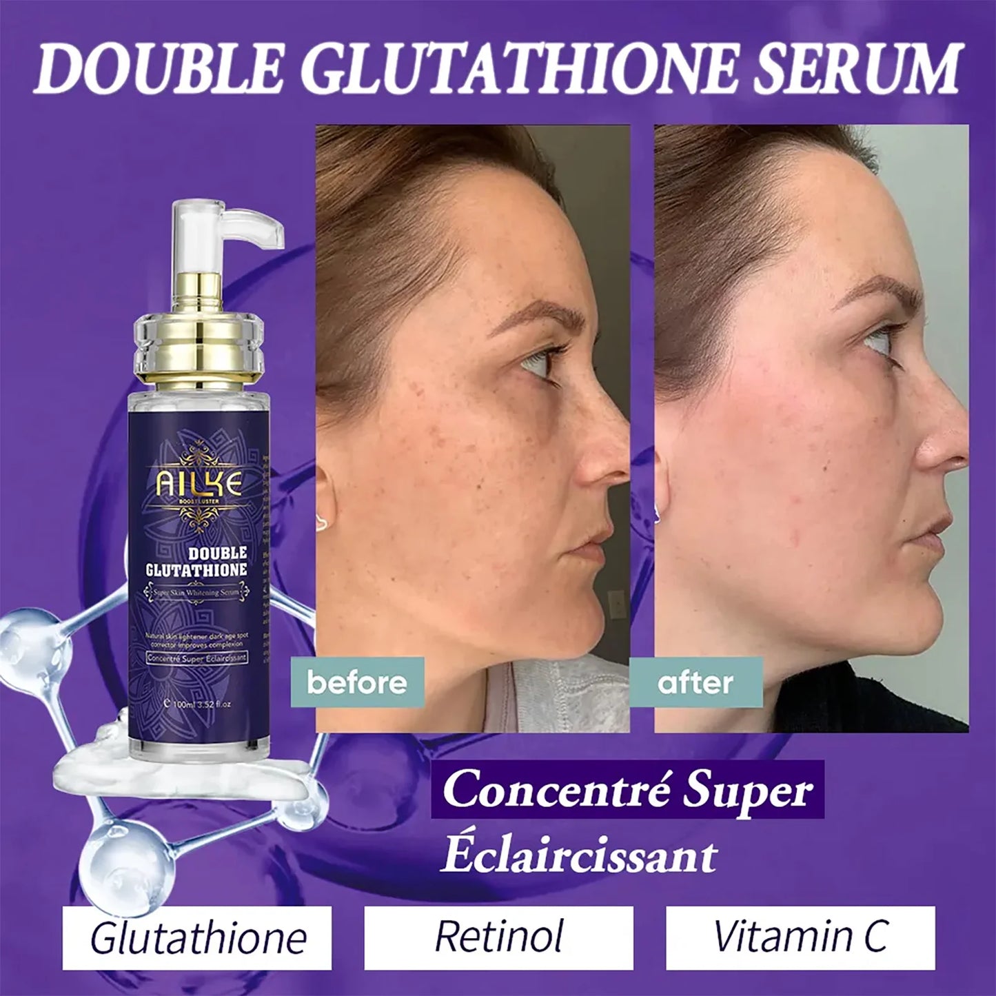 AILKE Glutathione Whitening Range For Radiant Bright Skin